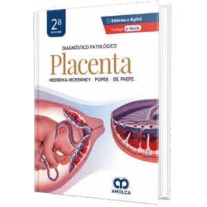 DIAGNOSTICO PATOLOGICO PLACENTA 2ED