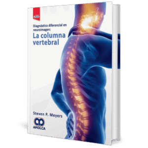 DIAGNOSTICO DIFERANCIAL EN NEUROIMAGEN: LA COLUMNA VERTEBRAL