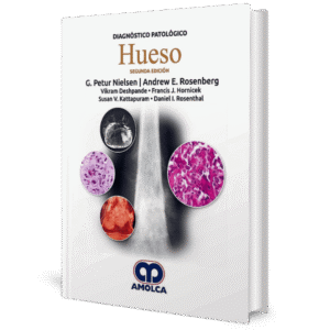 DIAGNOSTICO PATOLOGICO HUESO 2ED