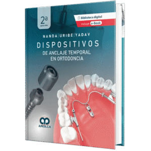 DISPOSITIVOS DE ANCLAJE TEMPORAL EN ORTODONCIA