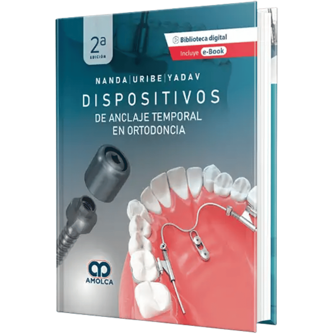 Dispositivos de Anclaje Temporal en Ortodoncia Nanda