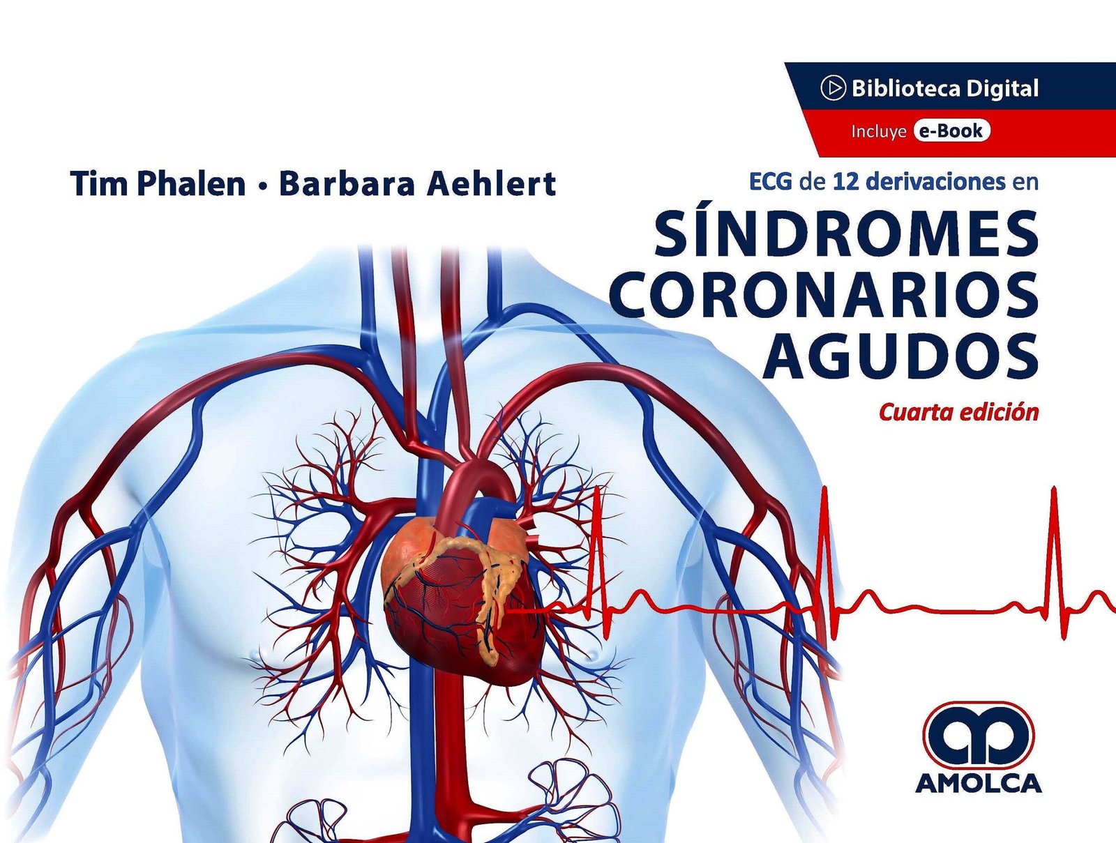 ECG DE 12 DERIVACIONES EN SINDROMES CORONARIOS AGUDOS 4ED - Imagen 2