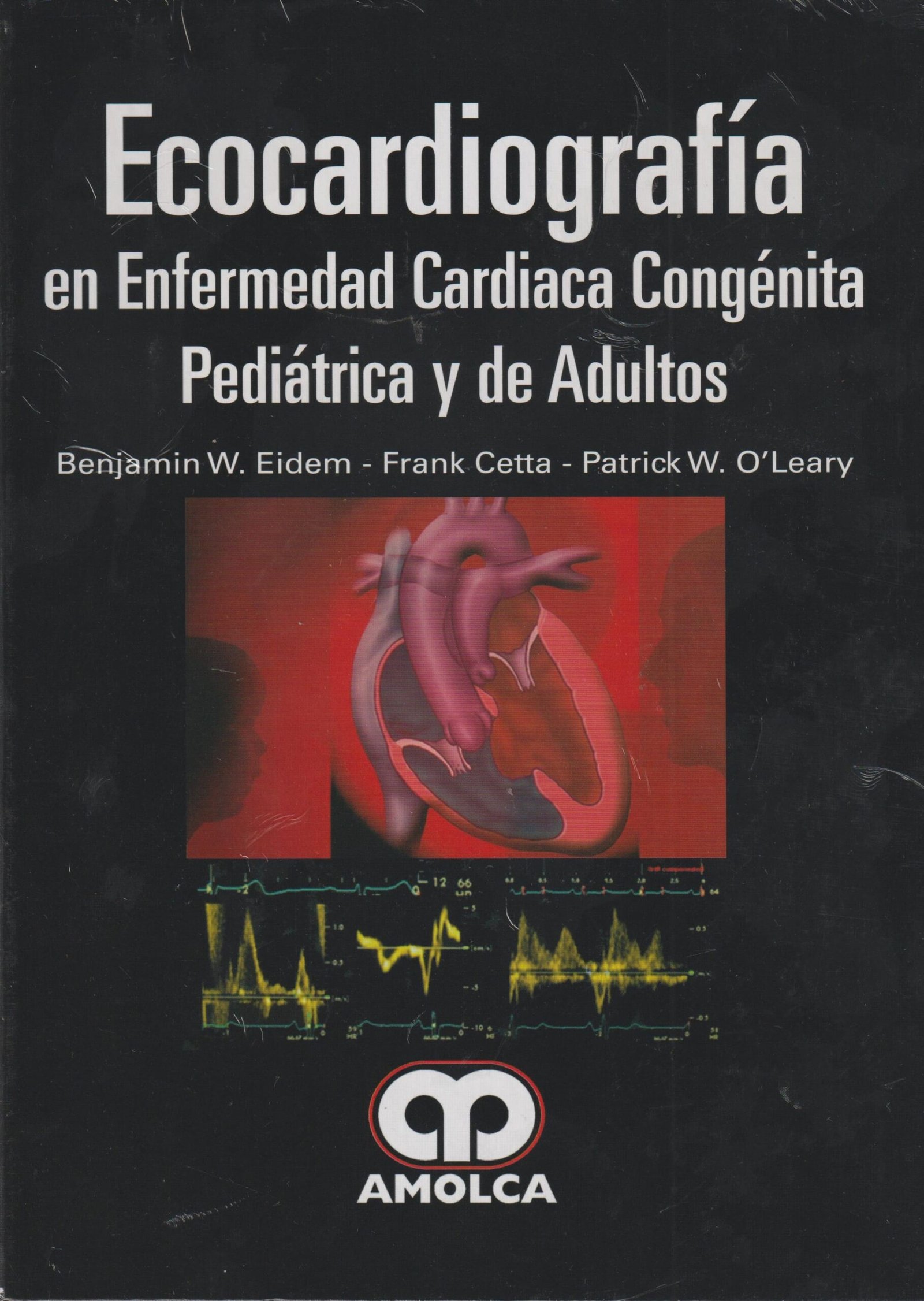 ECOCARDIOGRAFIA EN ENFERMEDAD CARDIACA CONGENITA PEDIATRICA Y DE ADULTOS - EIDEM