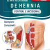 EL ARTE DE LA CIRUGIA DE HERNIA VENTRAL E INCISIONAL - CAMPANELLI