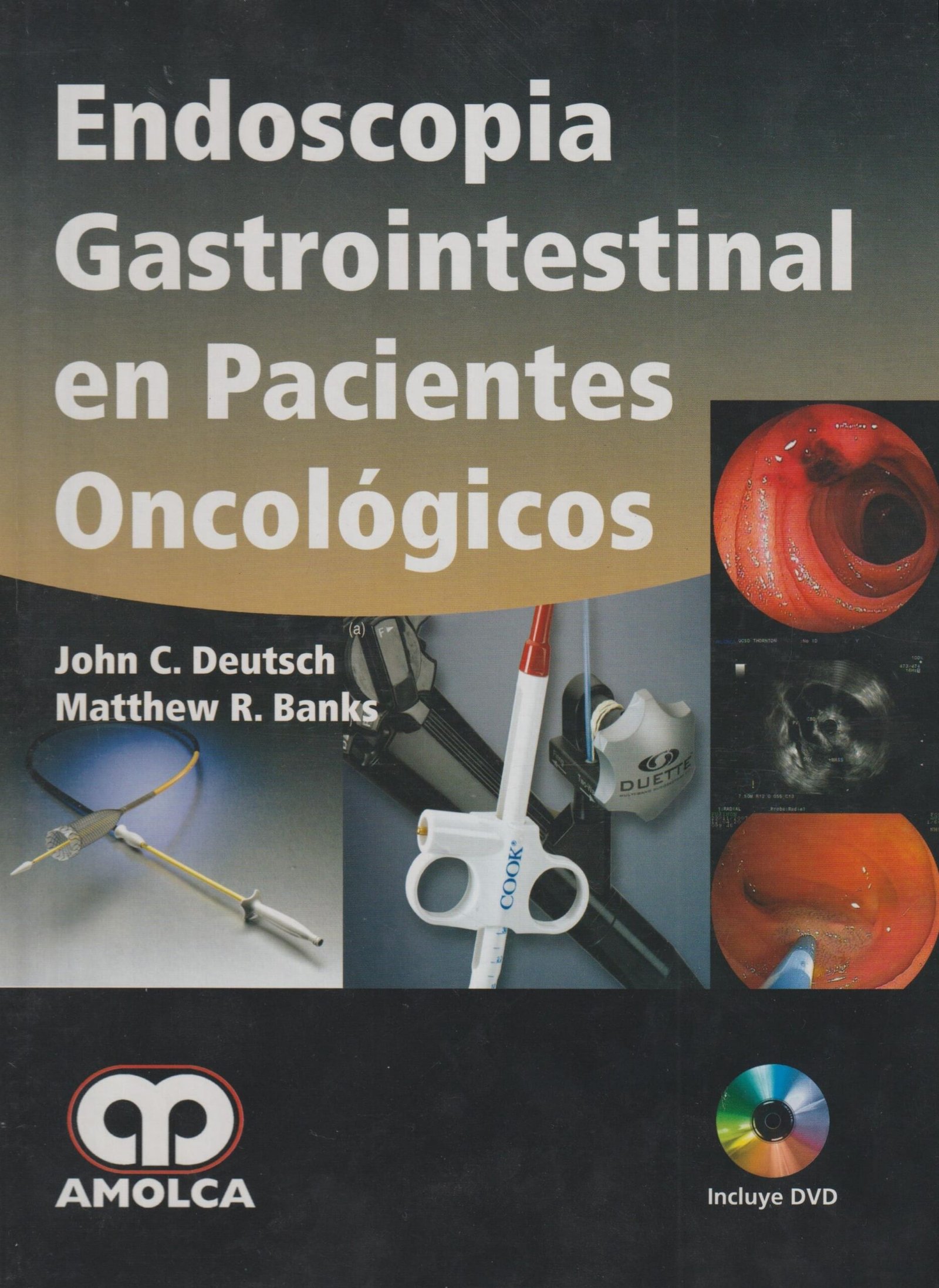 ENDOSCOPIA GASTROINTESTINAL EN PACIENTES ONCOLOGICOS - Imagen 2