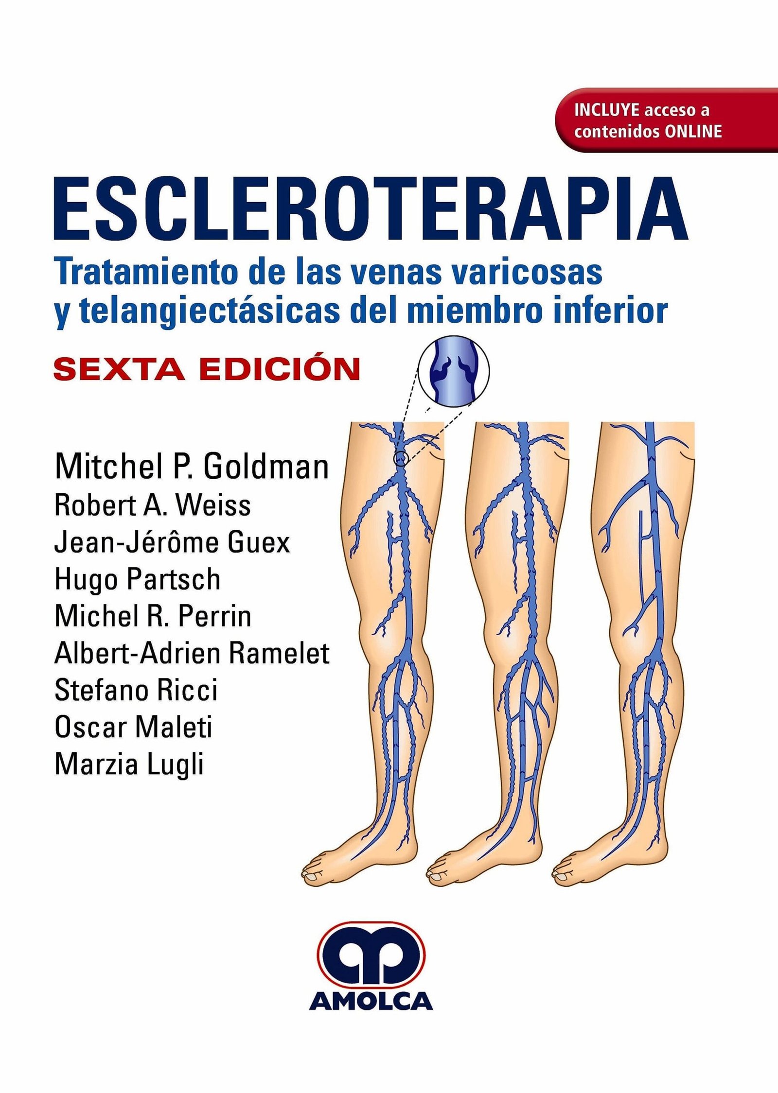 ESCLEROTERAPIA TRATAMIENTO DE LAS VENAS VARICOSAS Y TELANGIECTASICAS DEL MIEMBRO SUPERIOR 6ED - GOLDMAN