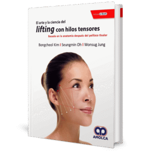 EL ARTE Y LA CIENCIA DEL LIFTING CON HILOS TENSORES BASADO EN LA ANATOMIA DESPUES DEL PELLIZCO TISULAR