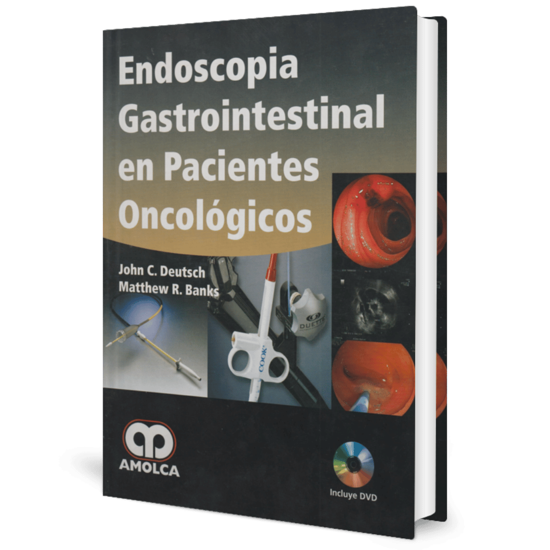 ENDOSCOPIA GASTROINTESTINAL EN PACIENTES ONCOLOGICOS - Imagen 1