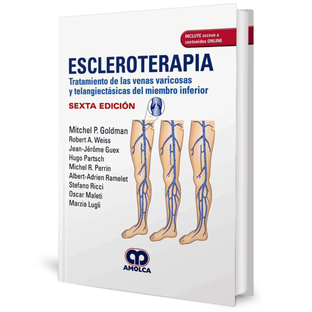 Escleroterapia tratamiento de las venas varicosas y telangiectasicas del miembro inferior 6ed Goldman