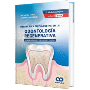 FIBRINA RICA EN PLAQUETAS EN LA ODONTOLOGÍA REGENERATIVA
