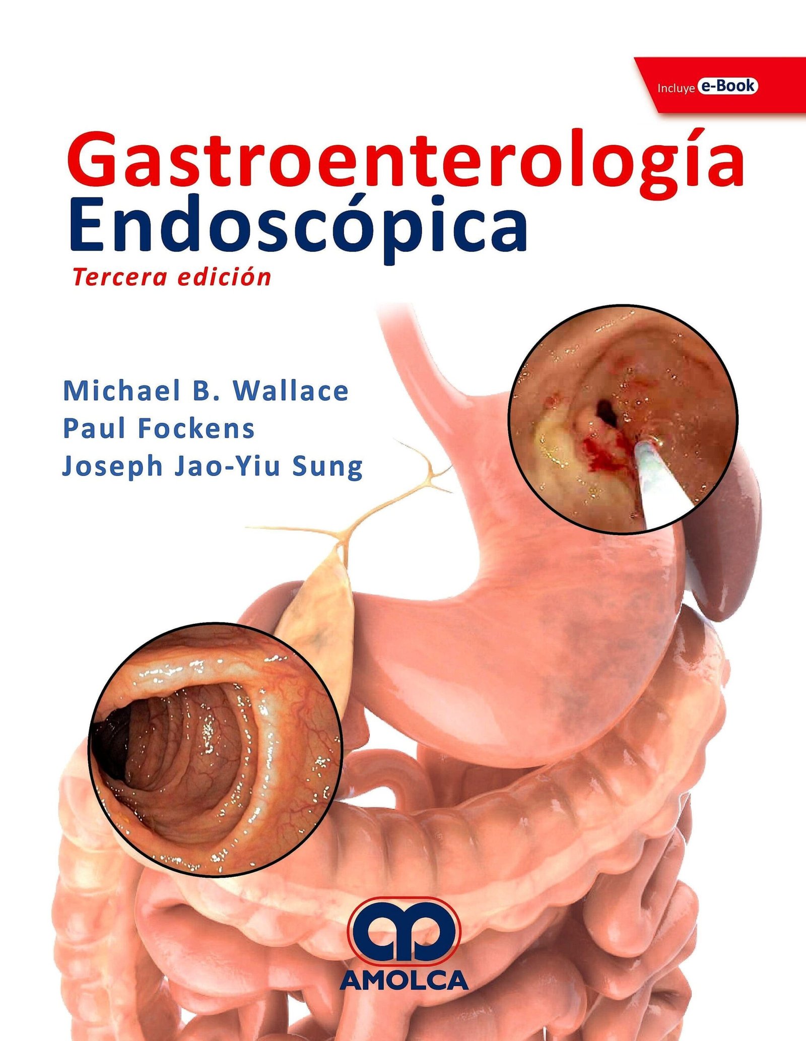 GASTROENTEROLOGIA ENDOSCOPICA 3ED - WALLACE