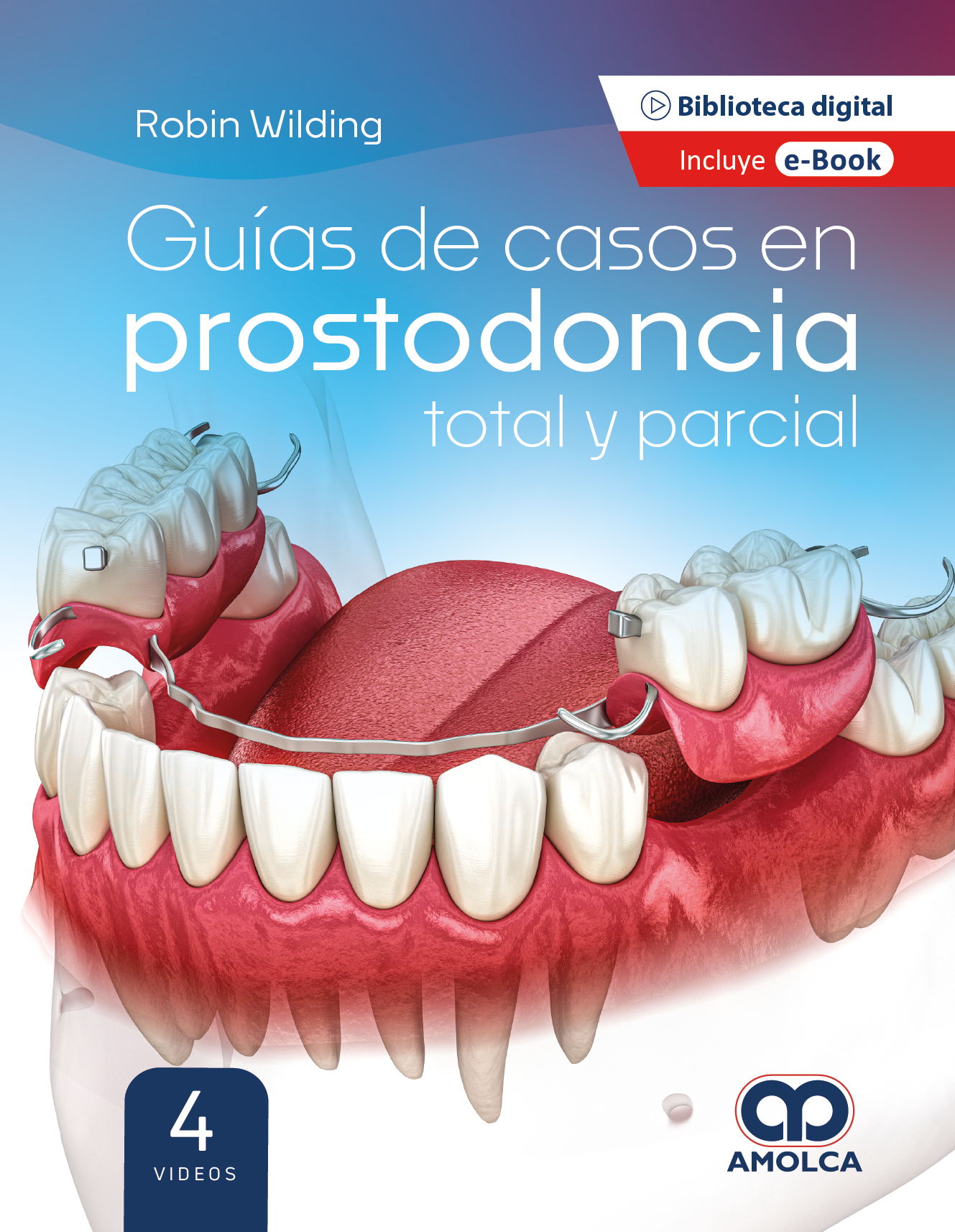 GUIAS DE CASOS EN PROSTODONCIA TOTAL Y PARCIAL - WILDING