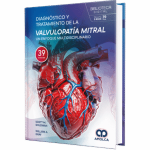 DIAGNOSTICO Y TRATAMIENTO DE LA VALVULOPATIA MITRAL UN ENFOQUE MULTIDISCIPLINARIO