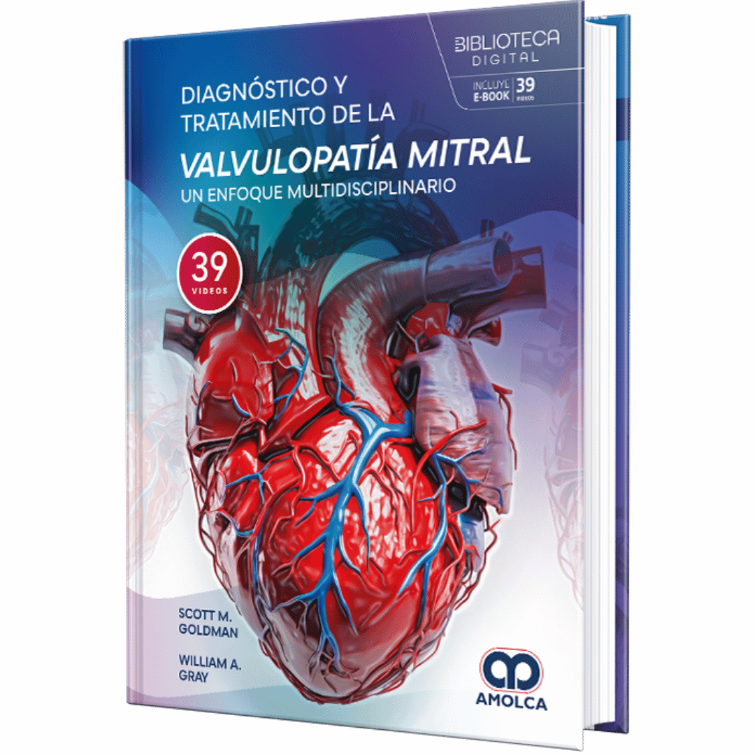 DIAGNOSTICO Y TRATAMIENTO DE LA VALVULOPATIA MITRAL UN ENFOQUE MULTIDISCIPLINARIO - Imagen 1