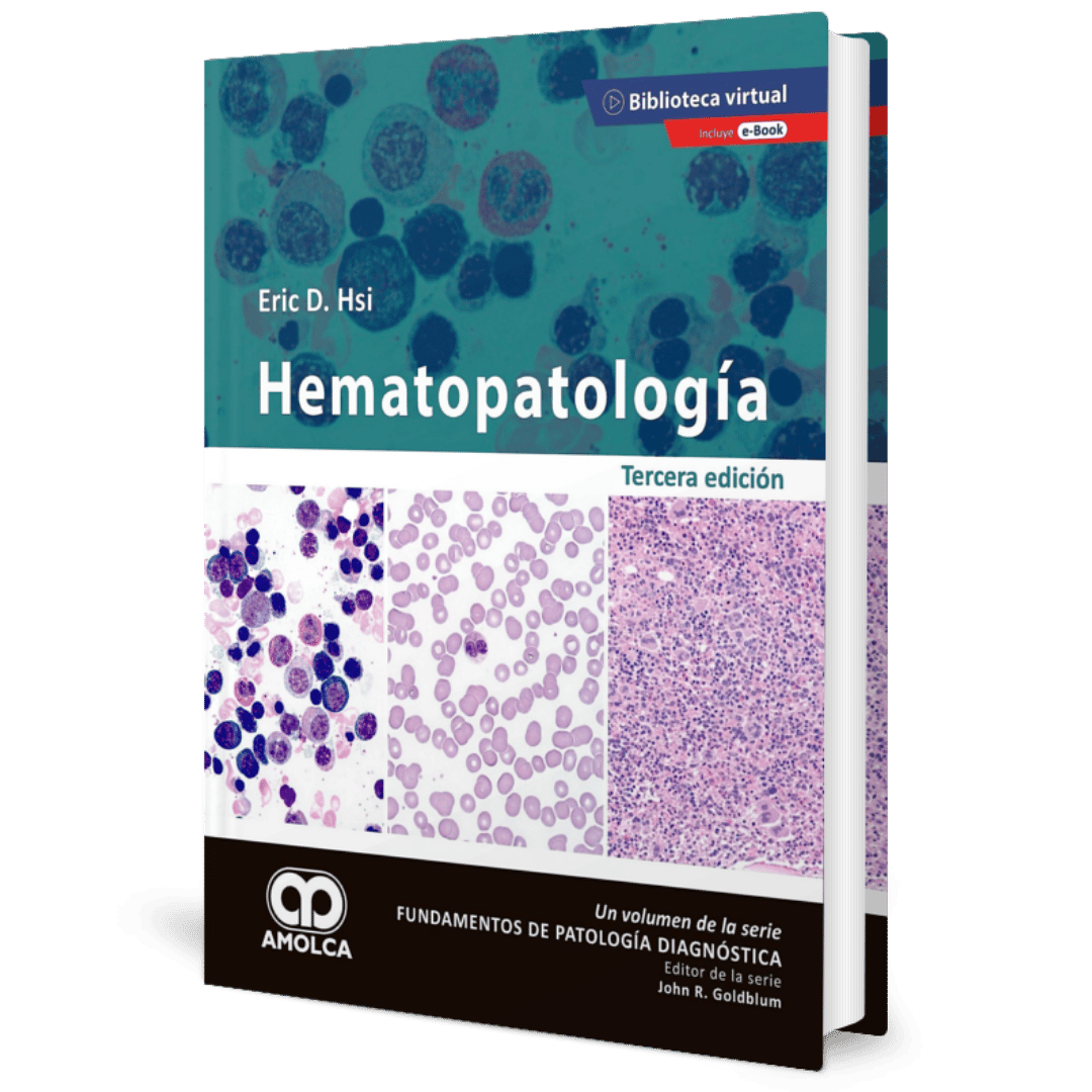 Hematopatologia 3ed Hsi