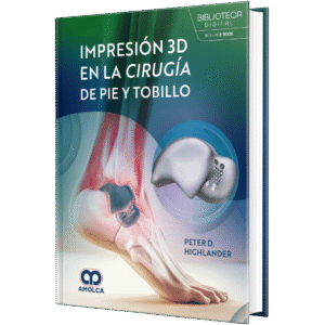 IMPRESION 3D EN LA CIRUGIA DE PIE Y TOBILLO