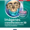 IMAGENES CRANEOFACIALES EN 3D - KADIOGLU