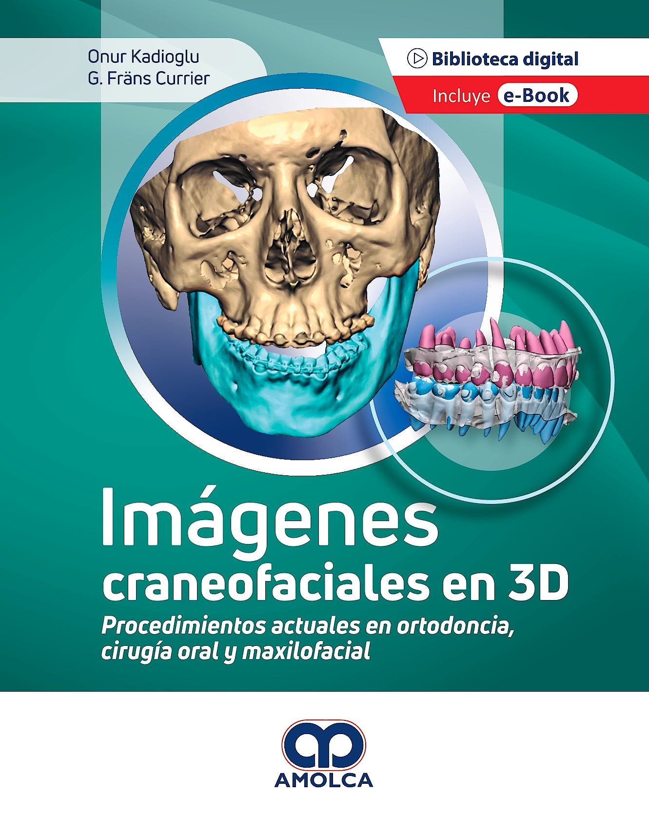 IMAGENES CRANEOFACIALES EN 3D - KADIOGLU