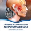 IMAGENES DE LA ARTICULACION TEMPOROMANDIBULAR - KALINOWSKA