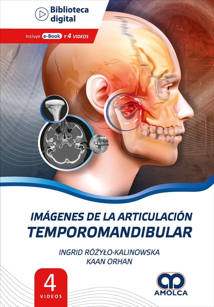 IMAGENES DE LA ARTICULACION TEMPOROMANDIBULAR - KALINOWSKA