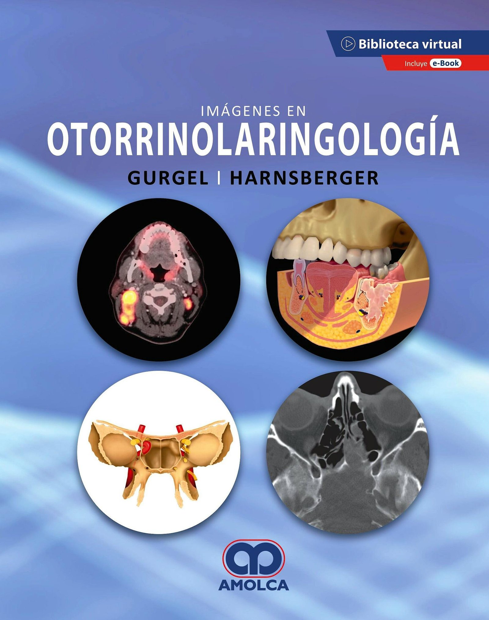 IMAGENES EN OTORRINOLARINGOLOGIA - Imagen 2