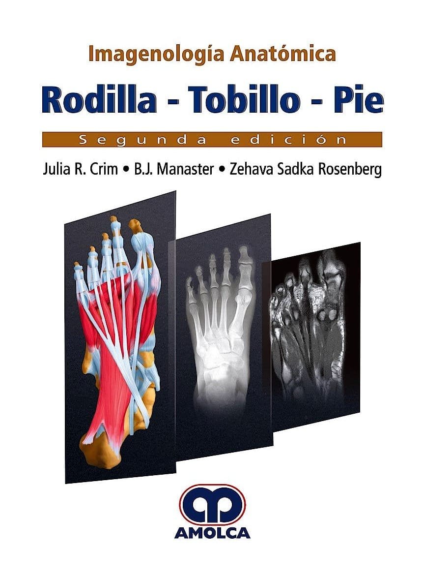 IMAGENOLOGIA ANATOMICA RODILLA TOBILLO PIE 2ED - CRIM