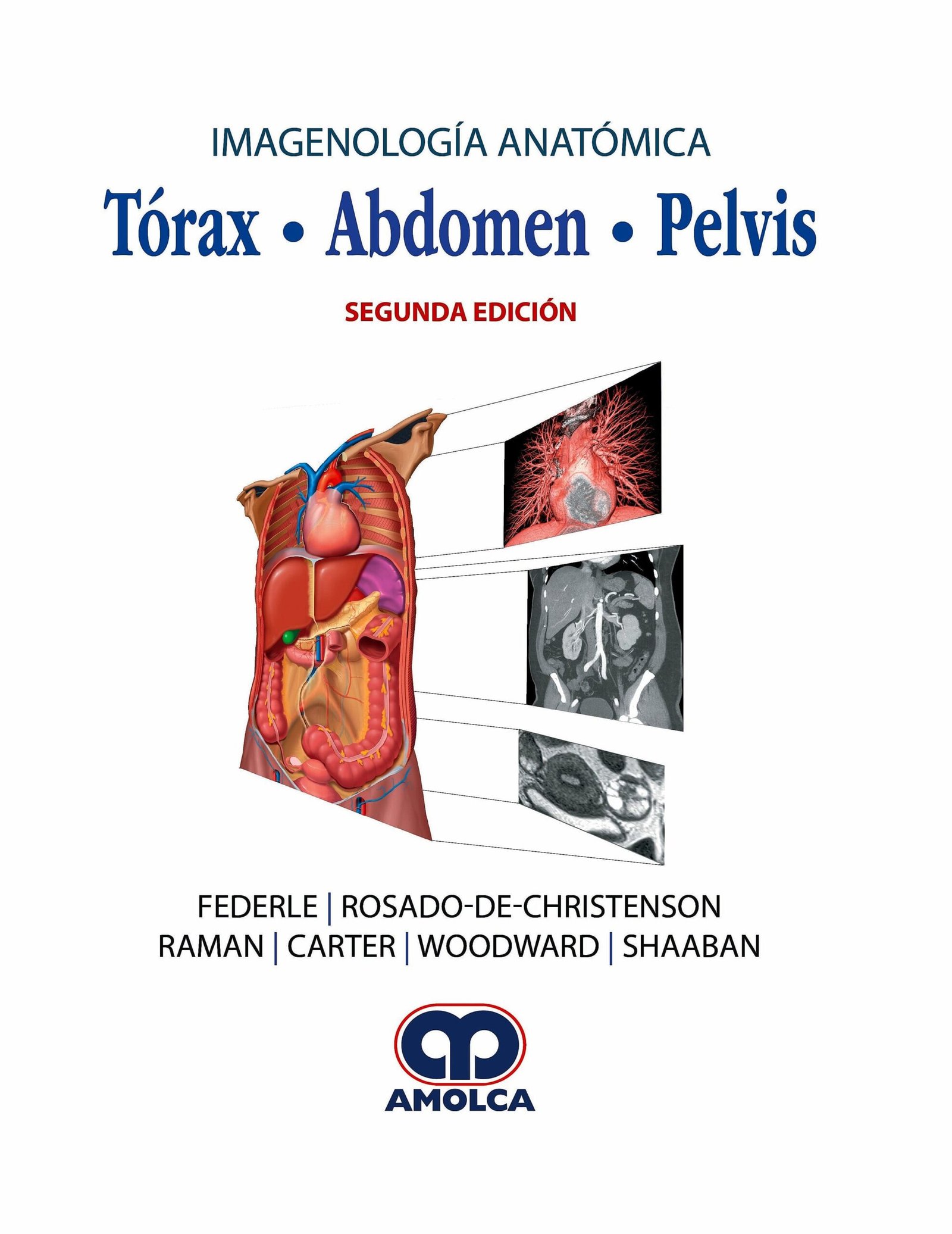 IMAGENOLOGIA ANATOMICA TORAX - ABDOMEN - PELVIS 2ED - Imagen 2