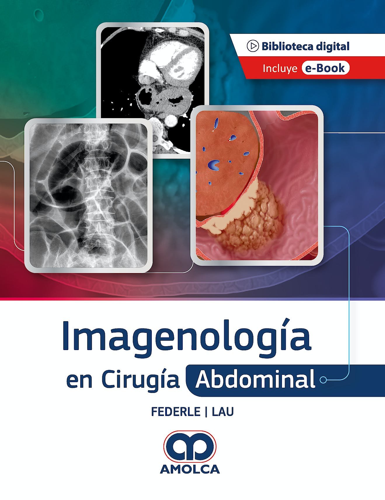 IMAGENOLOGIA EN CIRUGIA ABDOMINAL - FEDERLE