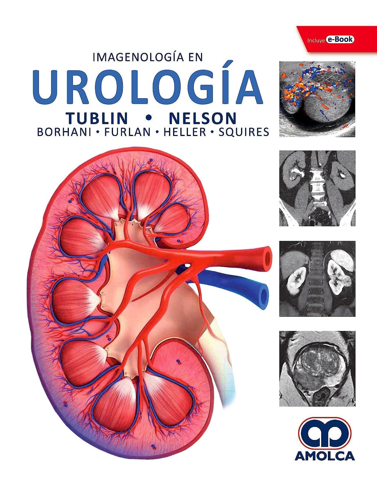 IMAGENOLOGIA EN UROLOGIA - TUBLIN