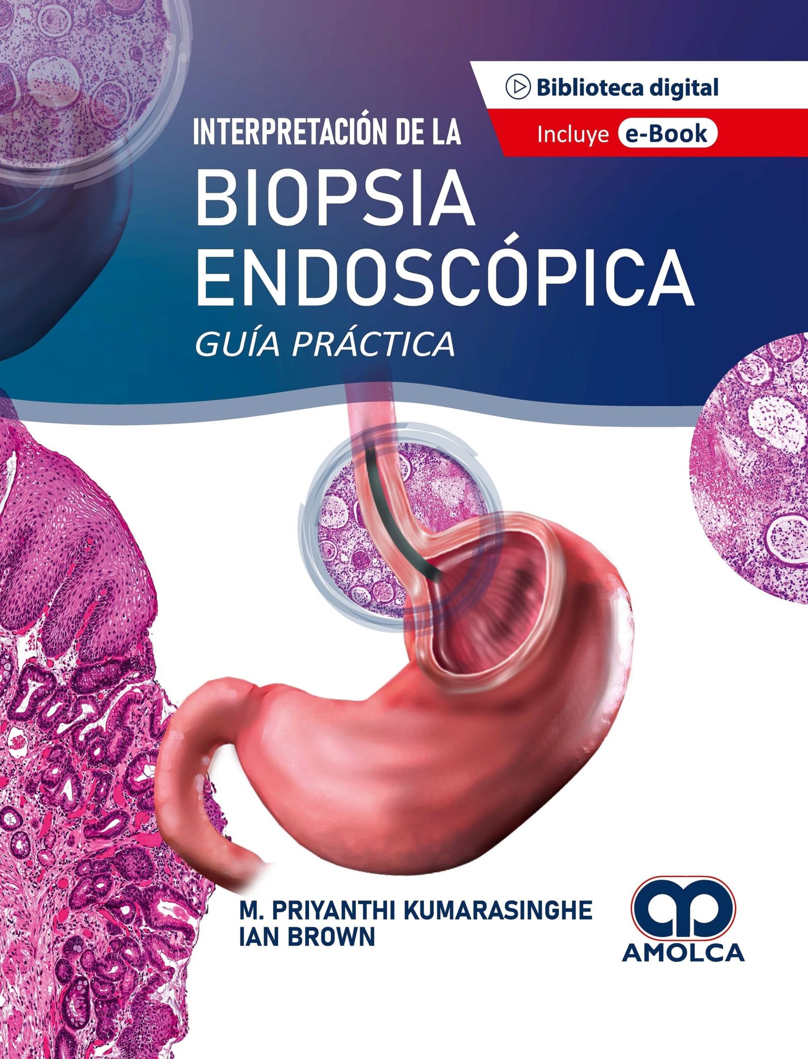 INTERPRETACION DE LA BIOPSIA ENDOSCOPICA GUIA PRACTICA - KUMARASINGHE