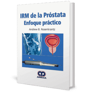 IRM DE LA PROSTATA ENFOQUE PRACTICO