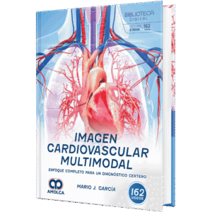 IMAGEN CARDIOVASCULAR MULTIMODAL. ENFOQUE COMPLETO PARA UN DIAGNOSTICO CERTERO 1ED