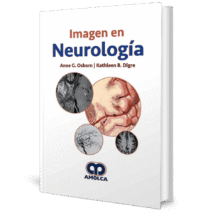 IMAGEN EN NEUROLOGIA