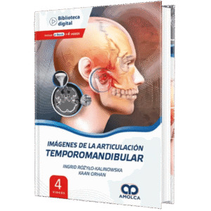 IMAGENES DE LA ARTICULACION TEMPOROMANDIBULAR