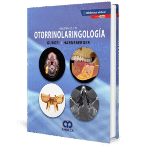 IMAGENES EN OTORRINOLARINGOLOGIA