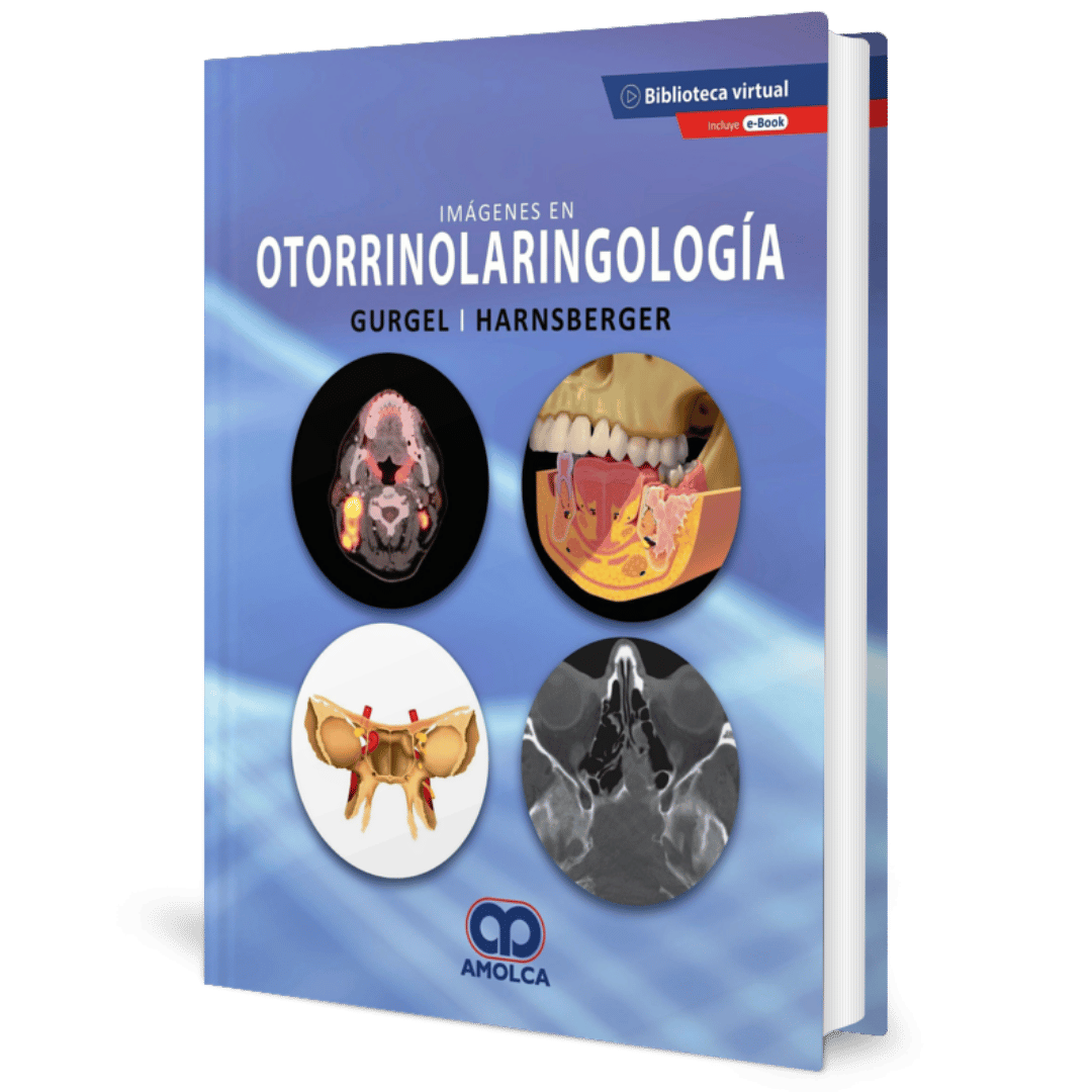 IMAGENES EN OTORRINOLARINGOLOGIA - Imagen 1