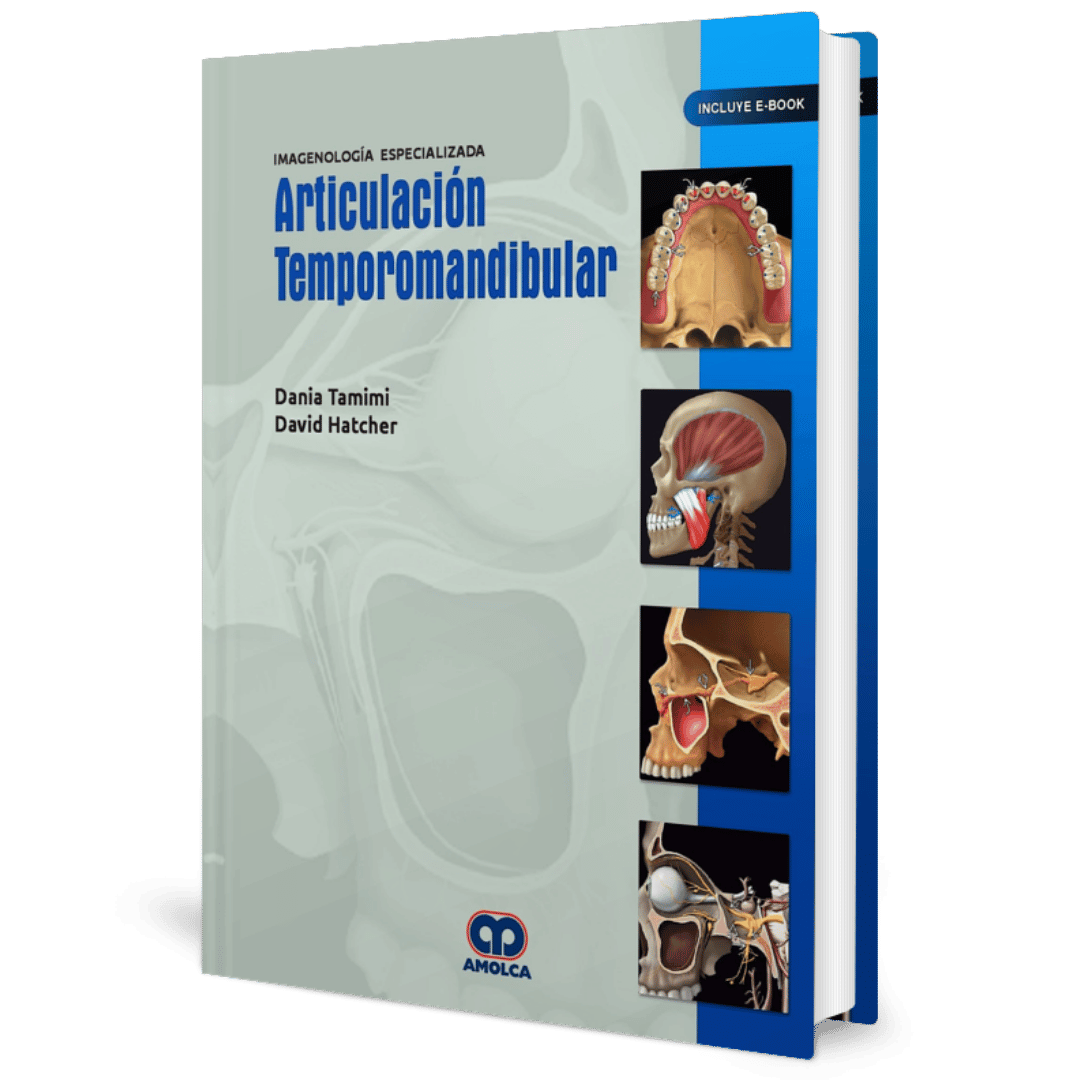 Imagenologia Especializada Articulacion Temporomandibular Tamimi