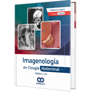 IMAGENOLOGIA EN CIRUGIA ABDOMINAL
