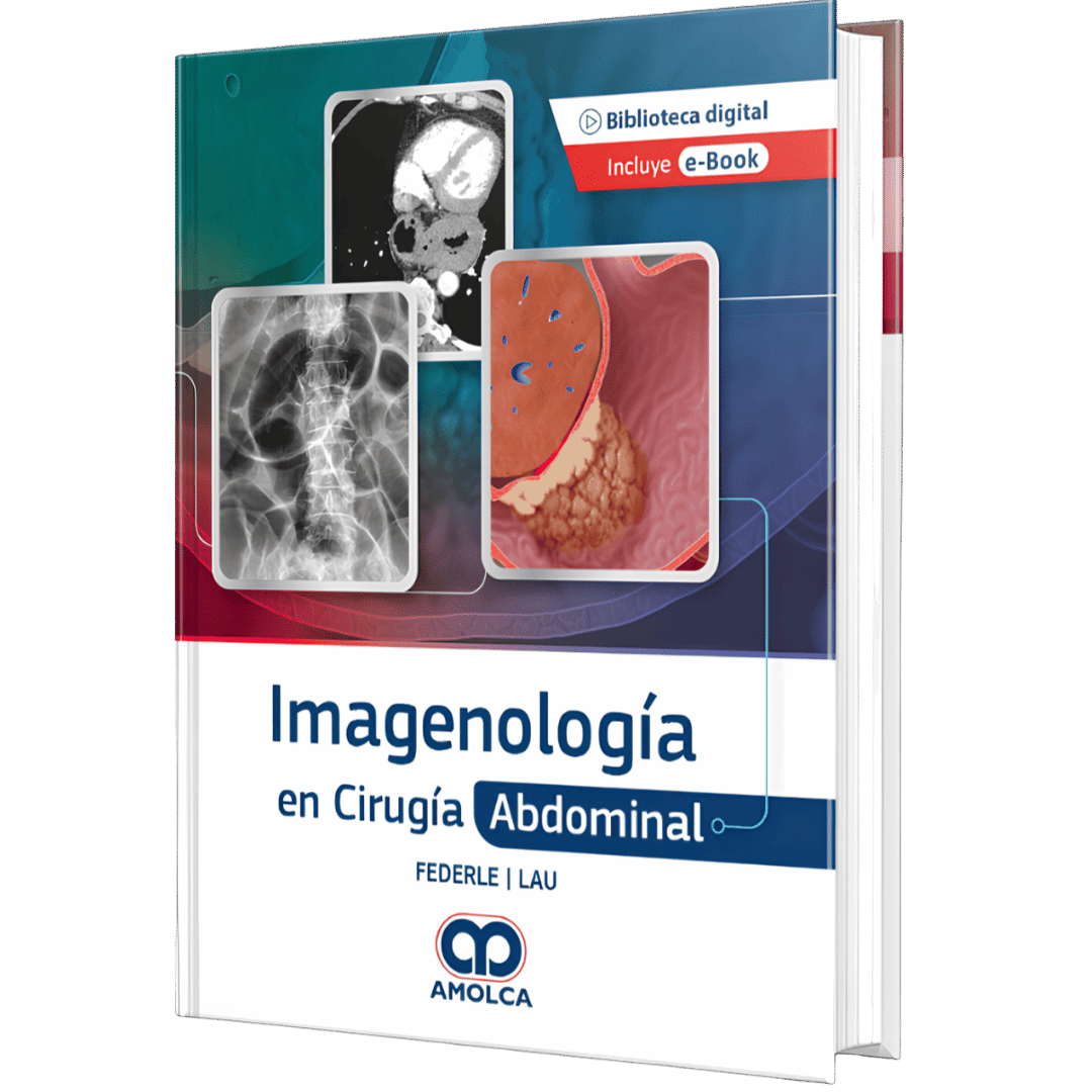 Imagenologia en Cirugia Abdominal Federle