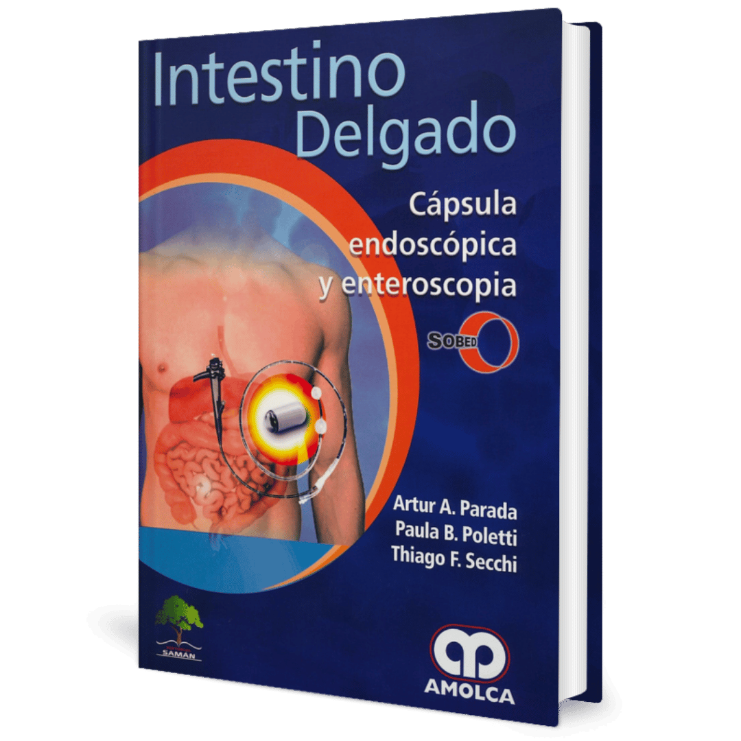 Intestino Delgado Capsula Endoscopica y Enteroscopia Parada