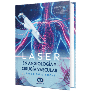 LASER EN ANGIOLOGIA Y CIRUGIA VASCULAR 1ED