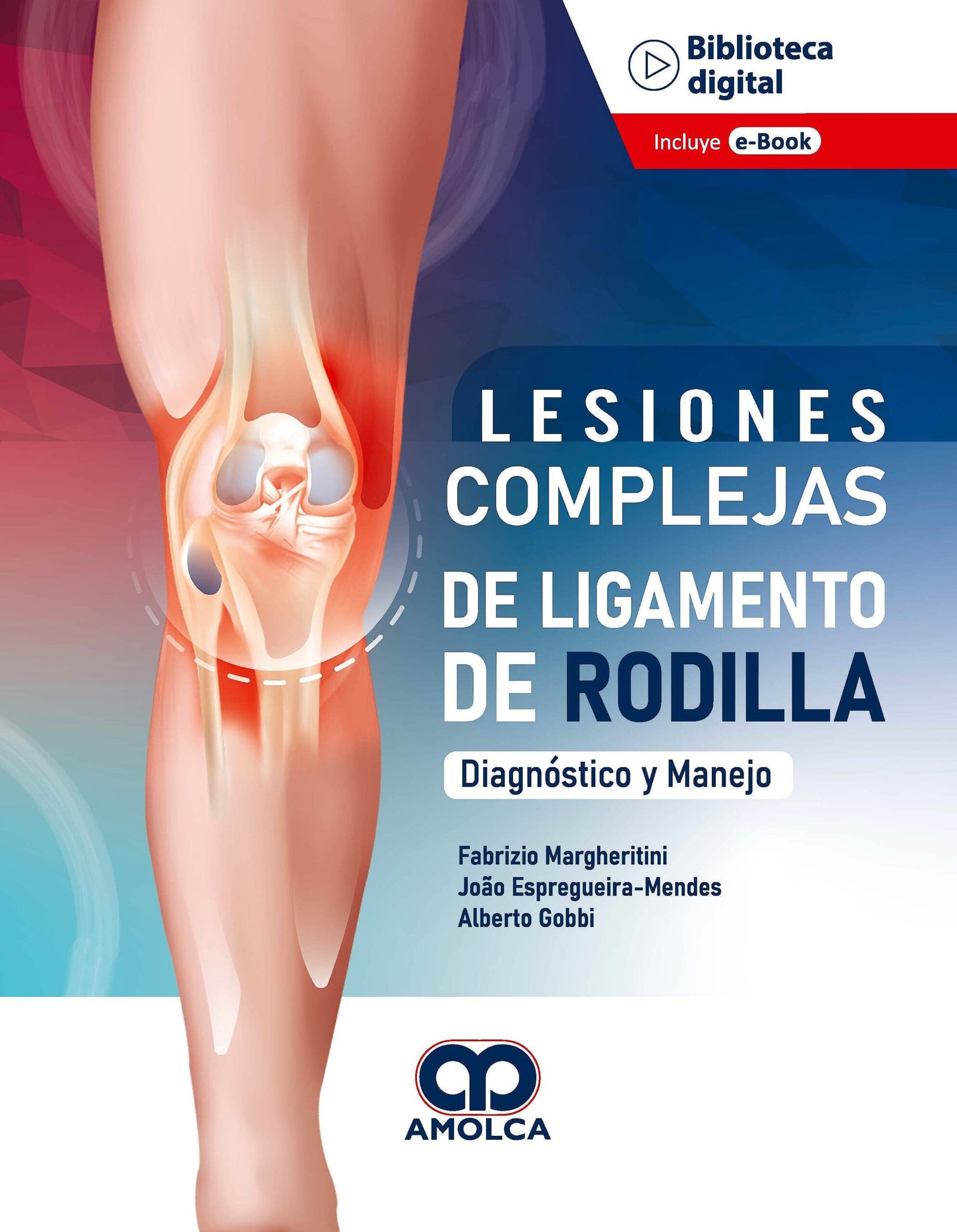 LESIONES COMPLEJAS DE LIGAMENTO DE RODILLA DEL DIAGNOSTICO AL MANEJO - MARGHERITINI