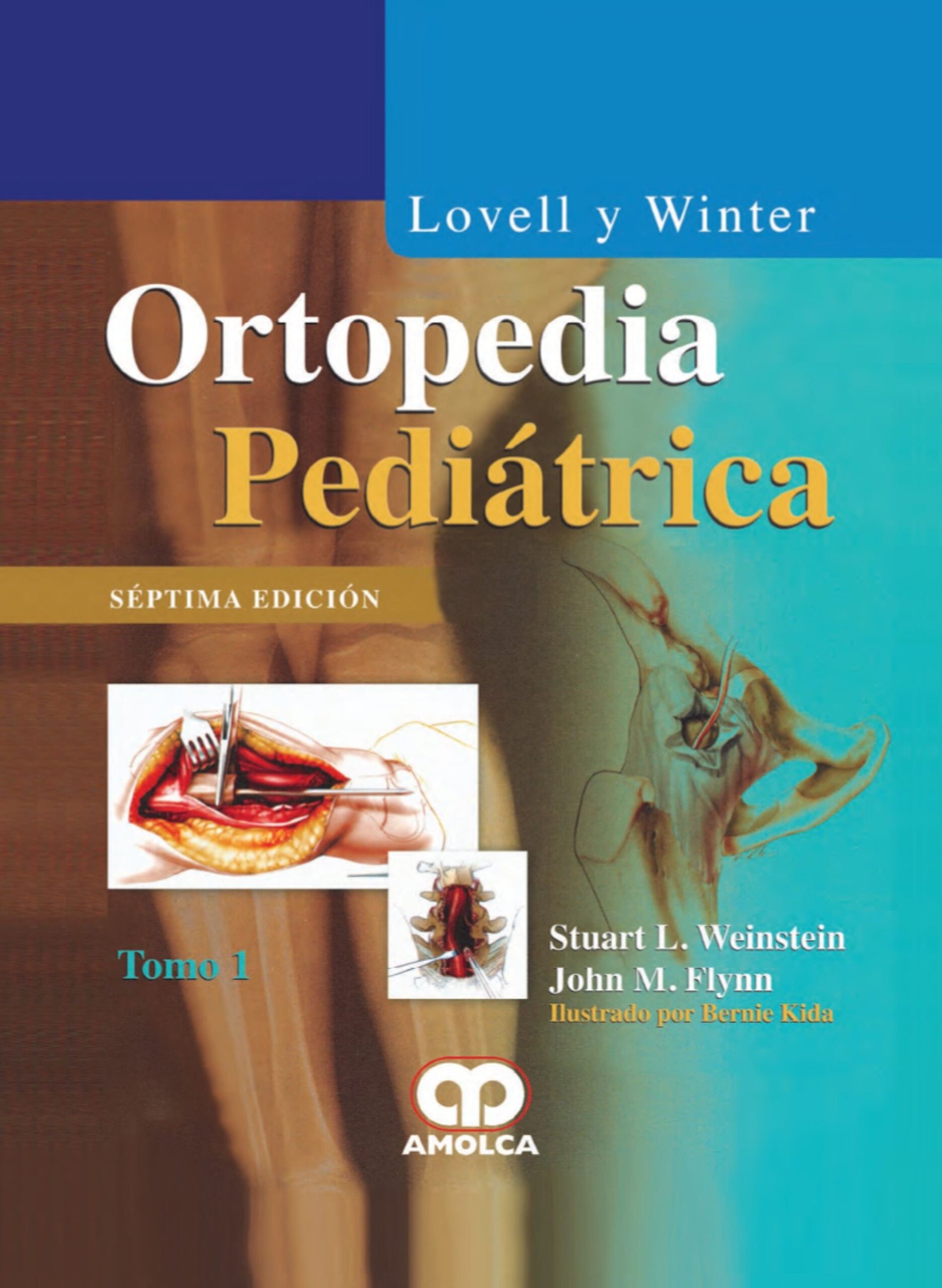 LOVELL Y WINTER ORTOPEDIA PEDIATRICA 7ED (2 TOMOS) - Imagen 2