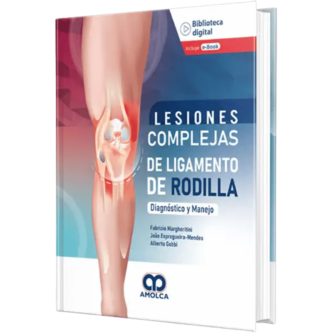 Lesiones Complejas deLigamento de Rodilla Margheritini