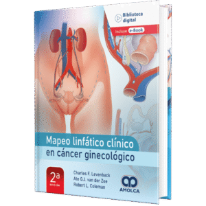 MAPEO LINFATICO CLINICO EN CANCER GINECOLOGICO 2ED