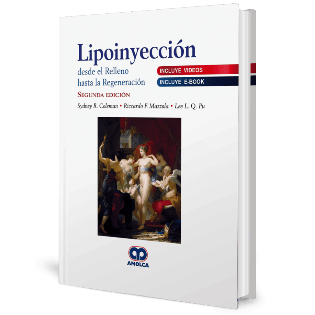 Lipoinyeccion desde el relleno hasta la regeneracion 2ed Coleman