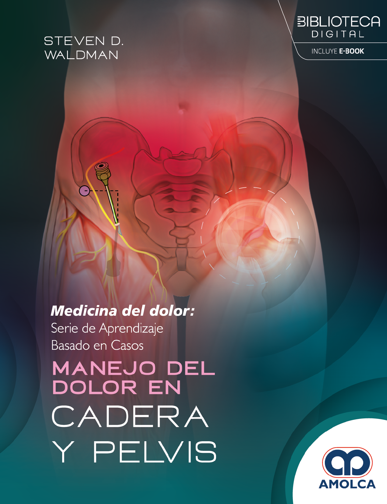MANEJO DEL DOLOR EN CADERA Y PELVIS - WALDMAN