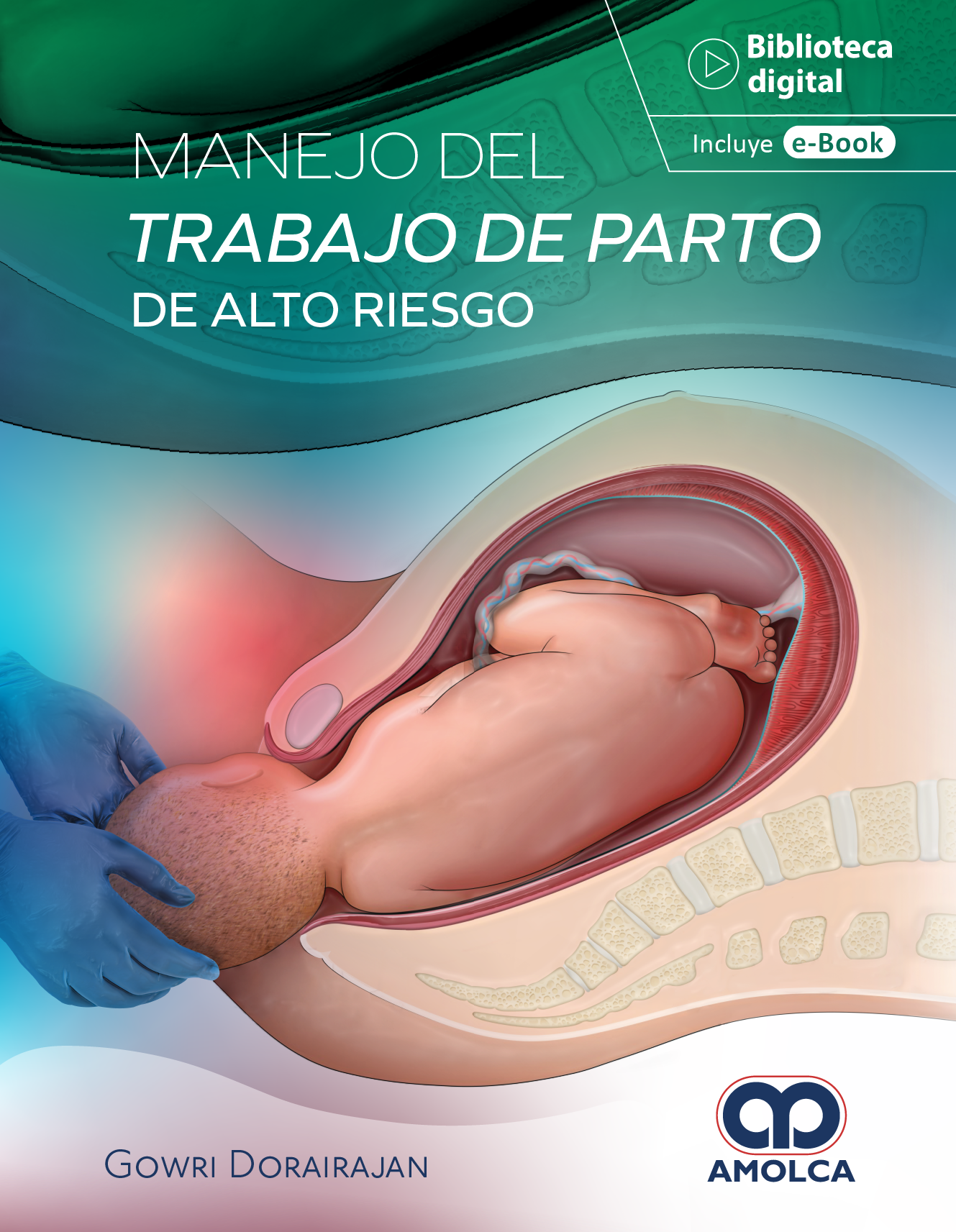 MANEJO DEL TRABAJO DE PARTO DE ALTO RIESGO 1ED - DORAIRAJAN