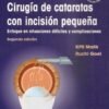 MANUAL DE CIRUGIA DE CATARATAS CON INCISION PEQUEÑA - MALIK