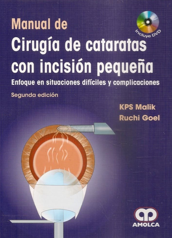 MANUAL DE CIRUGIA DE CATARATAS CON INCISION PEQUEÑA - MALIK